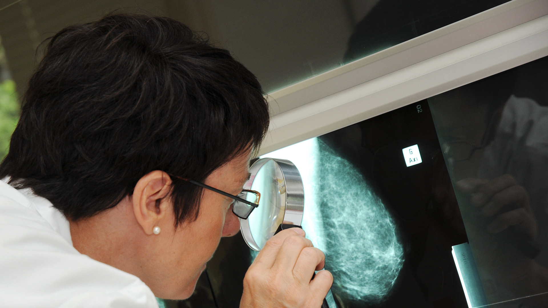 Centre de suivi des femmes à haut risque de cancer du sein et de l'ovaire, hôpital Tenon, AP-HP